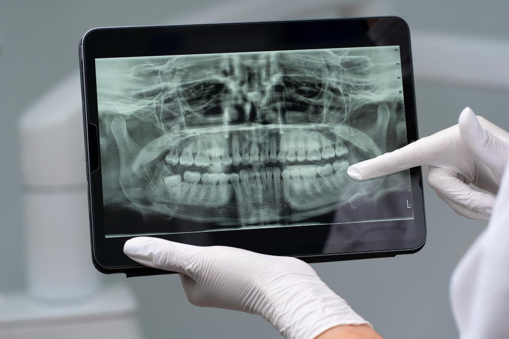 Digital X-Rays Harbor City, CA